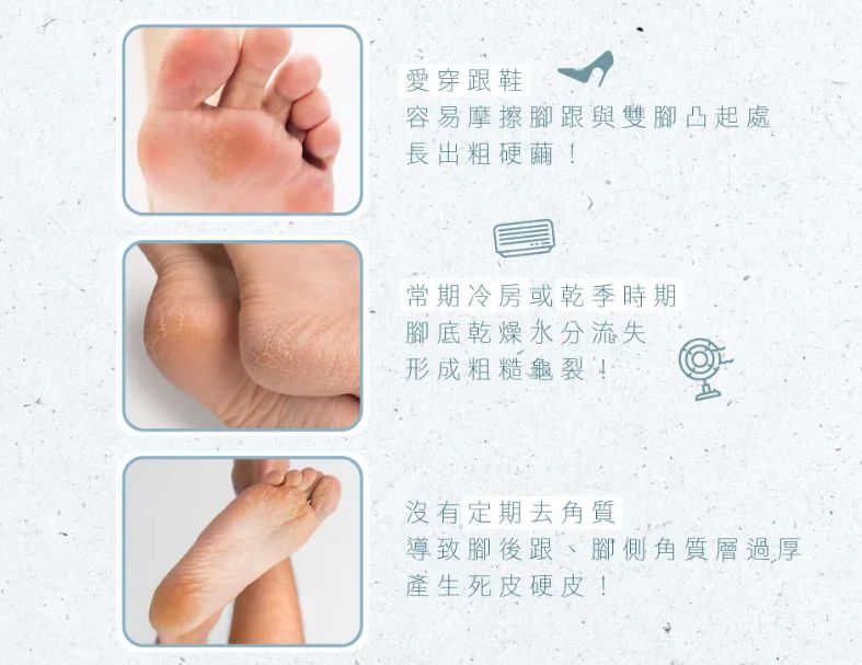 【KINYO】電動去角質磨皮美足機 